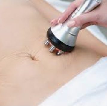 RF Skin Tightening